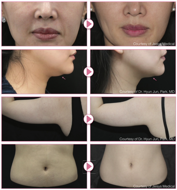 screenshot 2025 12 22 at 15.54.57 screenshot 2025 12 22 at 15.54.57